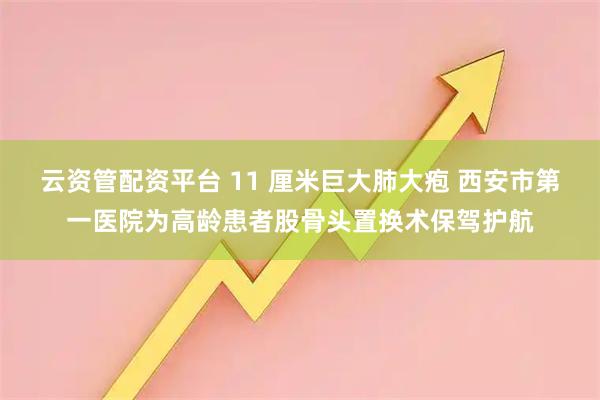 云资管配资平台 11 厘米巨大肺大疱 西安市第一医院为高龄患者股骨头置换术保驾护航